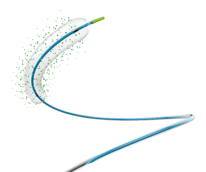PTCA Balloon Catheter Akan Mencapai Tanda CE Pada Augest, 2020