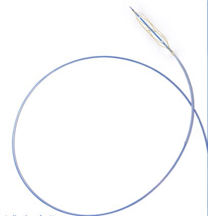 Kateter Belon Skor Ranty